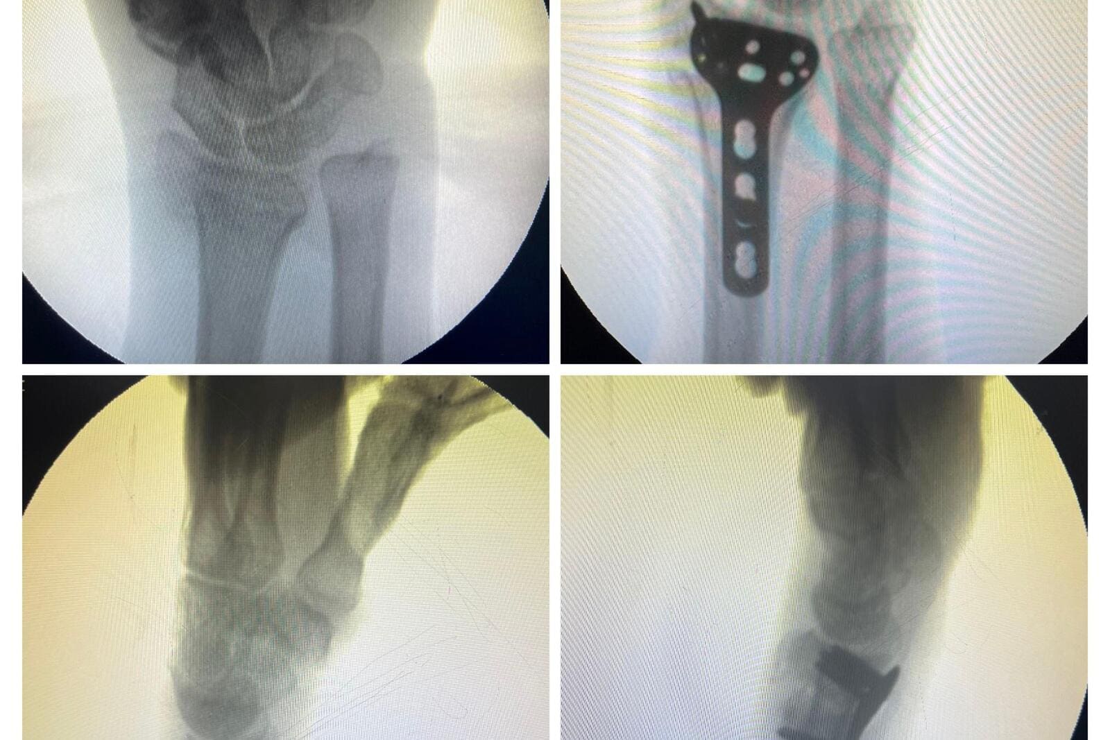 Sports Injuries & Arthroscopy