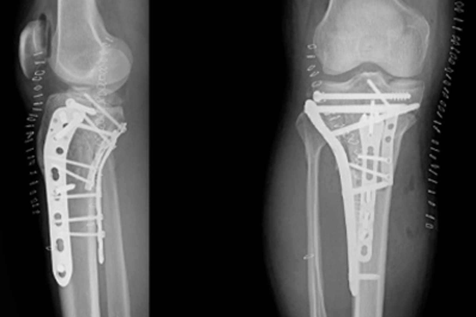 Trauma & Fracture Management